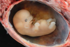 Human_Embryo_8_weeks