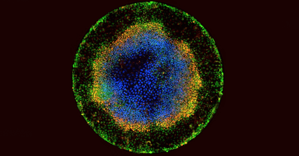 Embryoids, Ethics, Islam and Pot